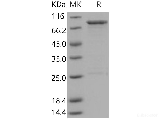 Recombinant Human OXSR1 / OSR1 Protein (GST tag)-Elabscience