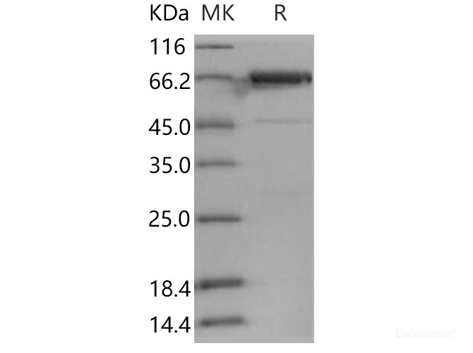 Recombinant Human PTK6 / Brk Protein (GST tag)-Elabscience