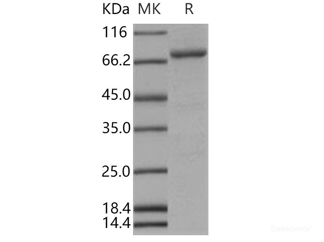 Recombinant Human Bruton Tyrosine Kinase / BTK Kinase Protein (His tag)-Elabscience