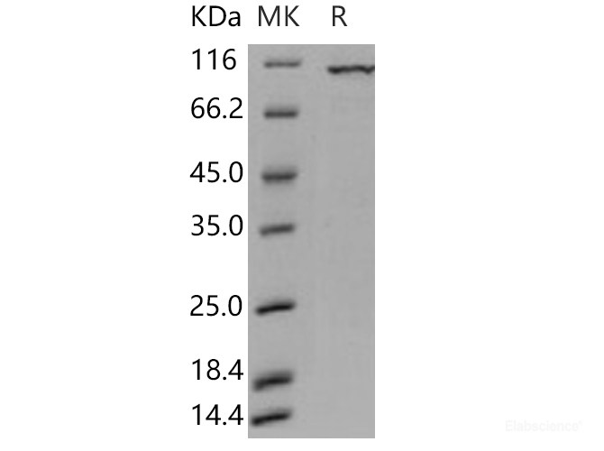 Recombinant Human PKC iota / PRKCI Protein (GST tag)-Elabscience