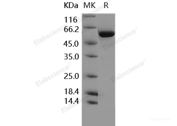 Recombinant Human TGFBR1 / ALK-5 / SKR4 Protein (aa 200-503, His & GST tag)-Elabscience