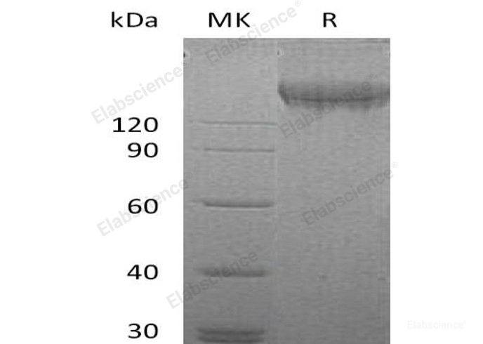 Recombinant Human VEGFR2 / KDR Protein (His &GST Tag)-Elabscience