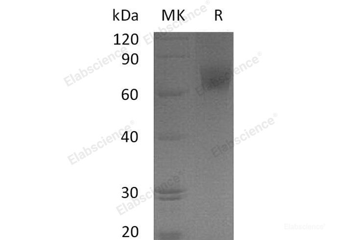 Recombinant Human EGFR / HER1 / ErbB1 (aa 668-1210) Protein (His & GST tag)-Elabscience