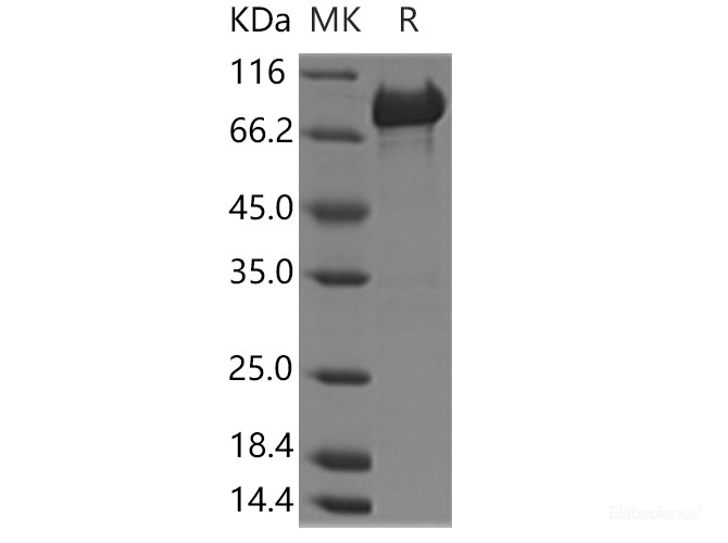 Recombinant Human PCK2 Protein (His & GST Tag)-Elabscience
