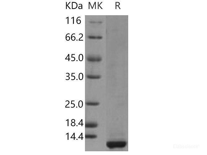 Recombinant Human CLPS / Colipase Protein (His tag)-Elabscience