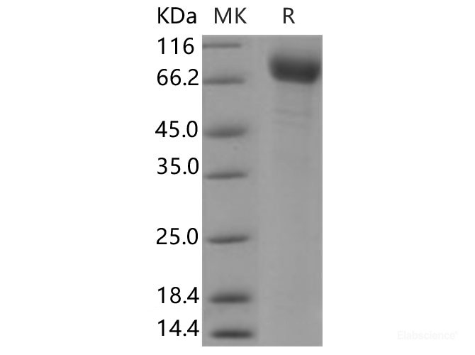 Recombinant Human TEM8 Protein (Fc Tag)-Elabscience