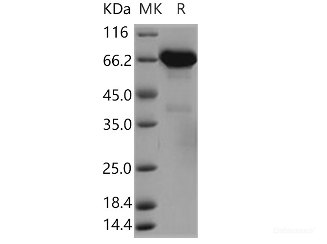 Recombinant Human ERP72 / PDIA4 Protein (His tag)-Elabscience