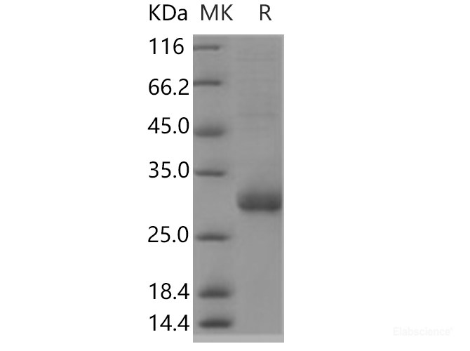 Recombinant Human TMED1 Protein (His tag)-Elabscience