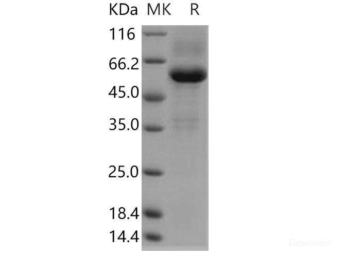 Recombinant Human TMED1 Protein (Fc tag)-Elabscience