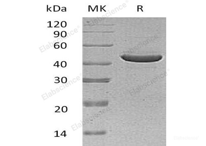 Recombinant Human SerpinB3 Protein (His Tag)-Elabscience