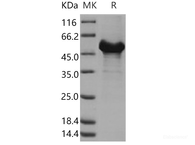 Recombinant Human RTN4 / NOGO-A Protein (GST tag)-Elabscience