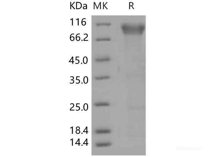 Recombinant Human BLNK / Ly-57 / SLP-65 Protein (His tag)-Elabscience