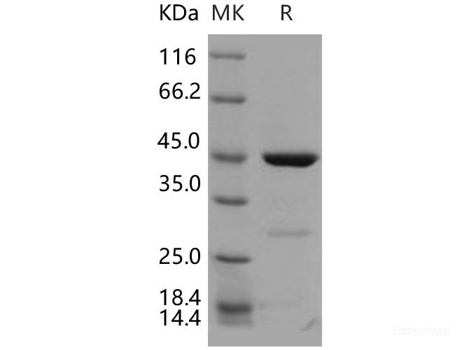 Recombinant Human CDKN2D / p19ink4d Protein (GST tag)-Elabscience