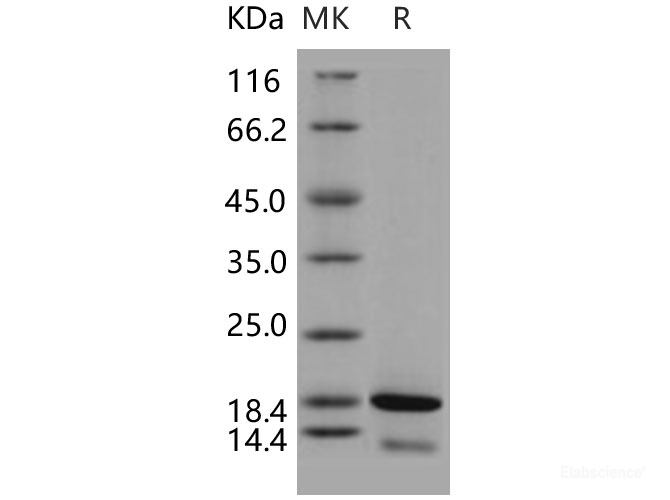 Recombinant Human CDK2AP2 Protein (His tag)-Elabscience