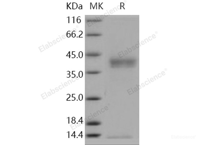 Recombinant Human Pancreasin / Marapsin / PRSS27 Protein (His tag)-Elabscience