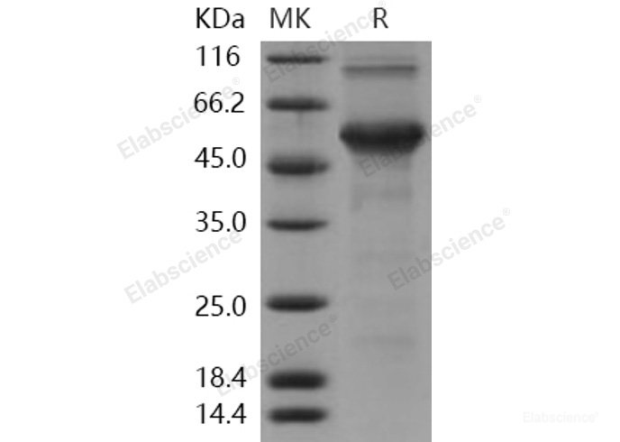 Recombinant Human DMP1 Protein (His tag)-Elabscience