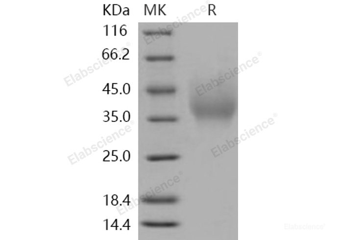 Recombinant Human DMBT1 / Muclin Protein (His tag)-Elabscience