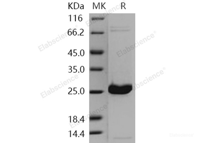 Recombinant Human UCHL1 / PGP9.5 Protein (His tag)-Elabscience