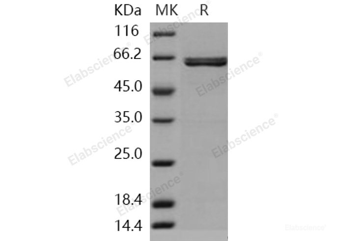 Recombinant Human AIM2 Protein (GST tag)-Elabscience