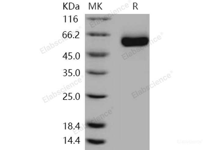Recombinant Human DLL1 / Delta-1 Protein (His tag)-Elabscience