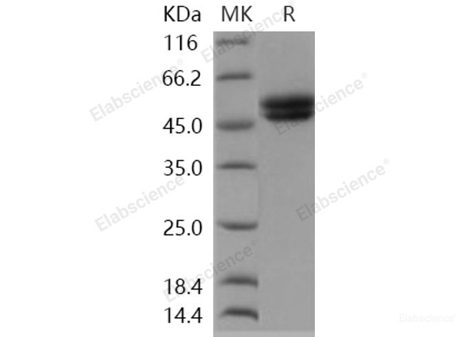 Recombinant Human AGER / RAGE Protein (His tag)-Elabscience