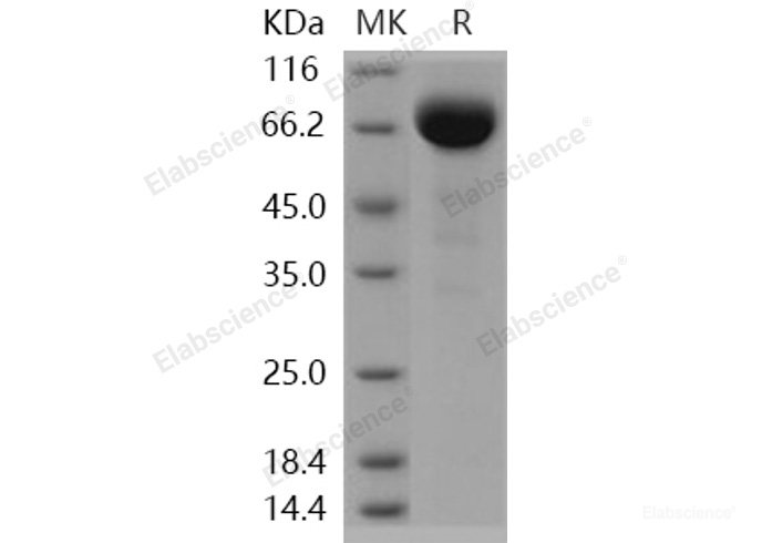 Recombinant Human EphA3 Protein (His tag)-Elabscience