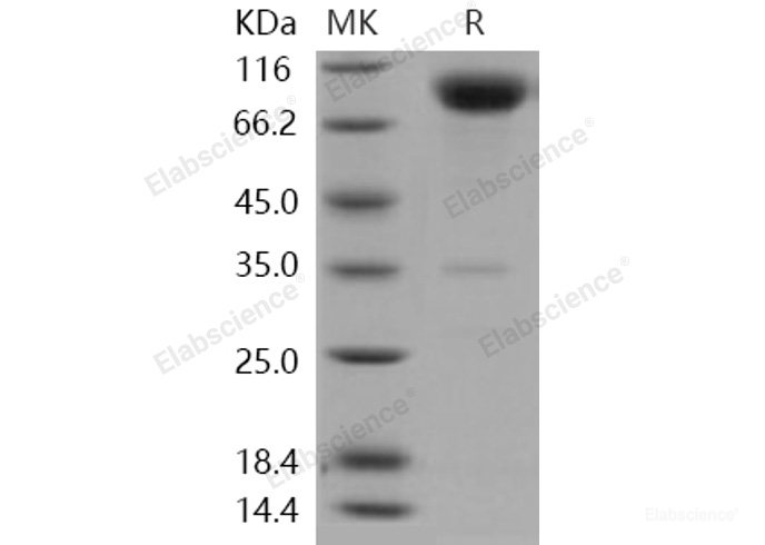 Recombinant Human CD200R1 Protein (His & Fc tag)-Elabscience