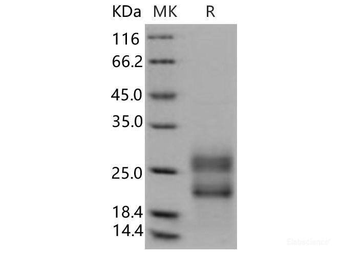 Recombinant Human RSPO3 Protein (aa 1-146, His Tag)-Elabscience