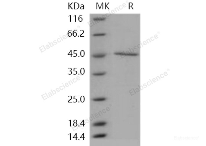 Recombinant Human GADD45A / DDIT-1 Protein (His & GST tag)-Elabscience