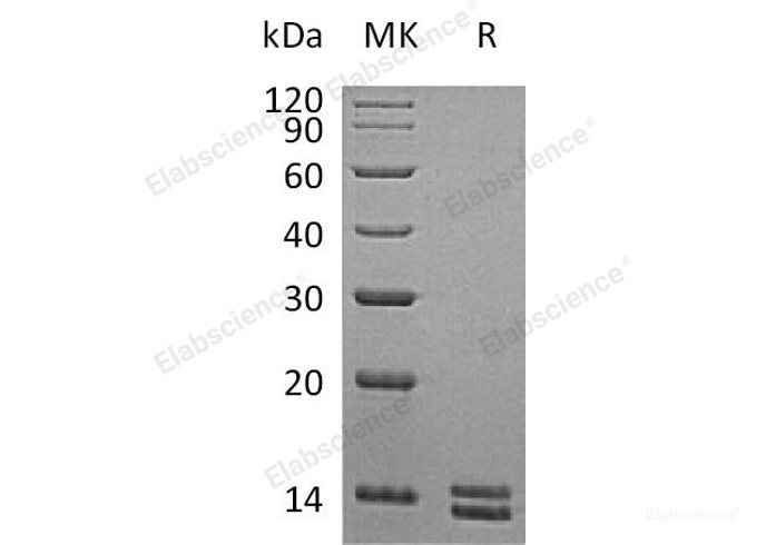 Recombinant Human S100A8 Protein (His Tag)-Elabscience