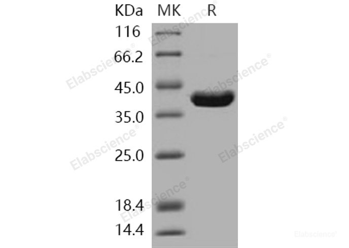 Recombinant Human ITCH / AIP4 Protein (aa 526-903)-Elabscience