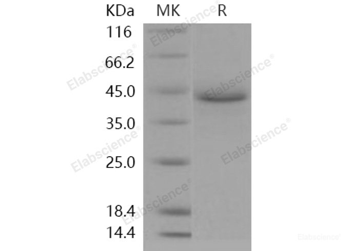 Recombinant Human LRPAP1 / A2MRAP Protein (His tag)-Elabscience
