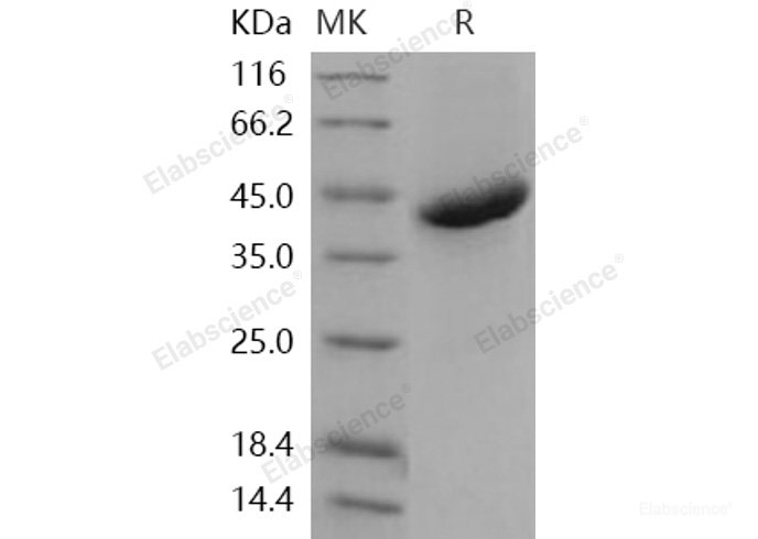 Recombinant Human R-Spondin 1 / RSPO1 Protein (His tag)-Elabscience