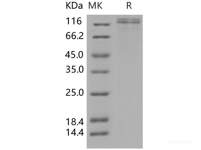 Recombinant Human VLDLR / VLDL Receptor Protein (His tag)-Elabscience