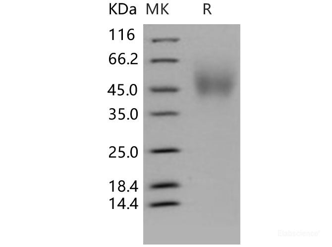 Recombinant Human TrkA / NTRK1 Protein (aa 194-413, His tag)-Elabscience