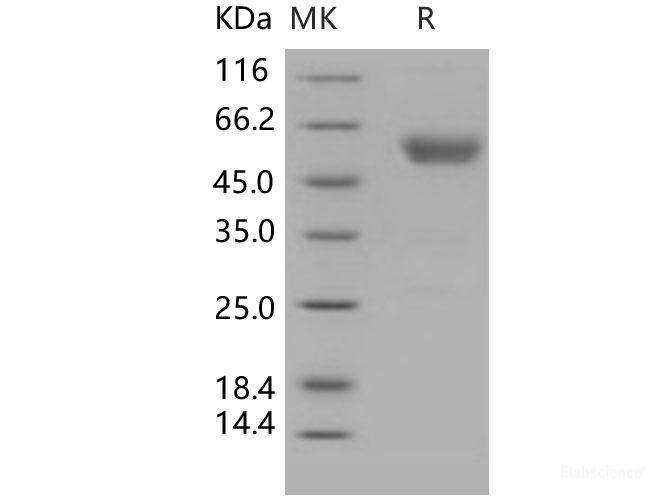 Recombinant Human Podoplanin / PDPN Protein (His & Fc tag)-Elabscience