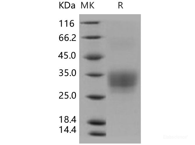 Recombinant Human CD7 Protein (His tag)-Elabscience