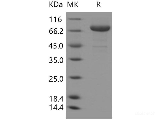 Recombinant Human Transferrin Receptor / TFRC / CD71 Protein (His tag)-Elabscience