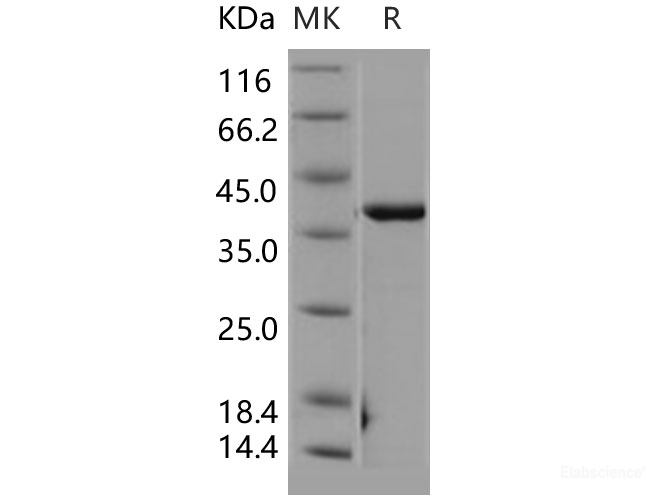 Recombinant Human CSNK2A2 / CK2A2 Protein-Elabscience