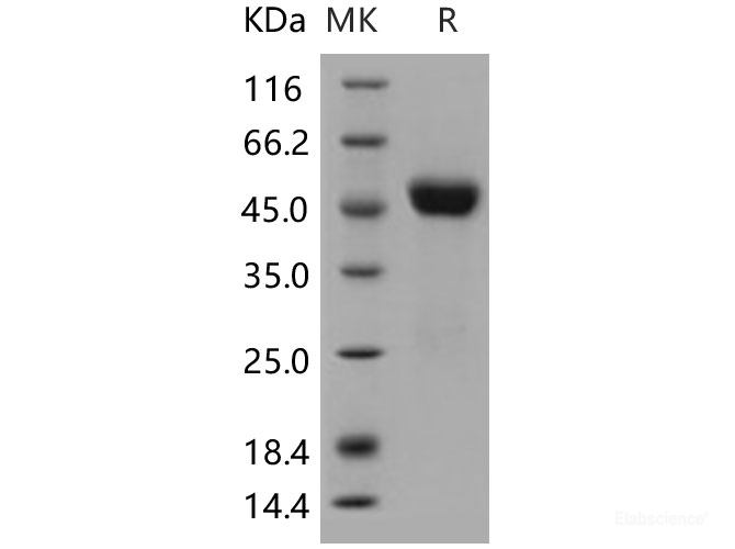 Recombinant Human CNTFR / CNTFR-alpha Protein (His tag)-Elabscience