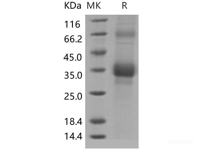 Recombinant Human CLEC1B / CLEC2 Protein (His tag)-Elabscience