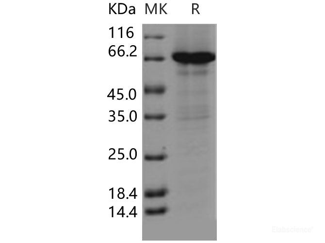 Recombinant Human CCNE1 / Cyclin-E1 Protein (His & GST tag)-Elabscience