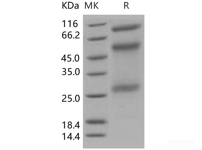Recombinant Human ADAM12 Protein (His tag)-Elabscience