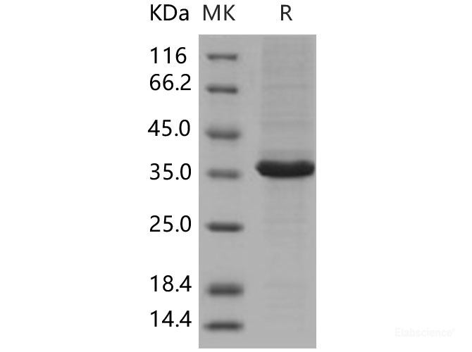 Recombinant Human MAP1D / Methionine Aminopeptidase 1D Protein (His tag)-Elabscience