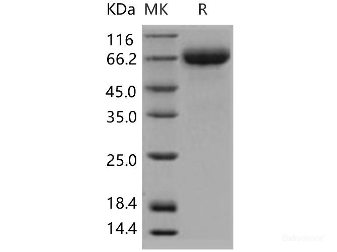 Recombinant Human Hemopexin / HPX Protein (His tag)-Elabscience