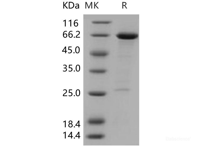 Recombinant Human HDAC8 / HDACL1 Protein (GST tag)-Elabscience