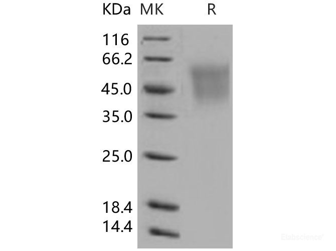 Recombinant Human CEACAM6 / CD66c Protein (His tag)-Elabscience