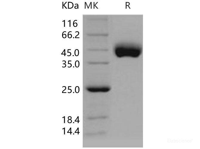 Recombinant Human CD21 / CR2 / C3DR Protein (His tag)-Elabscience