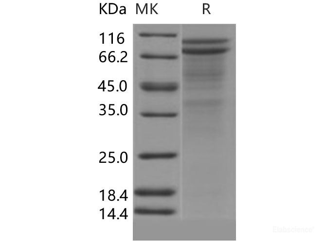 Recombinant Human DSC2 / Desmocollin-2 Protein (His tag)-Elabscience