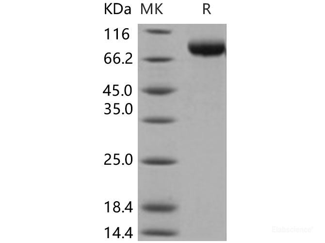 Recombinant Human MICB Protein (His & Fc tag)-Elabscience